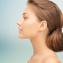 Rinoplastia